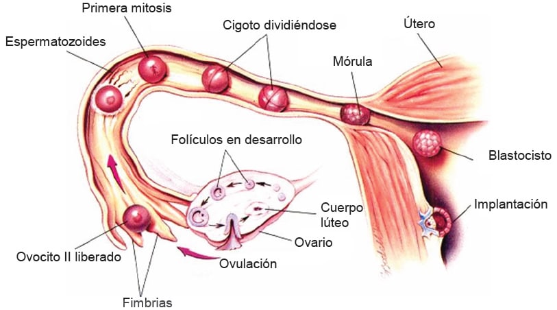 Implantación