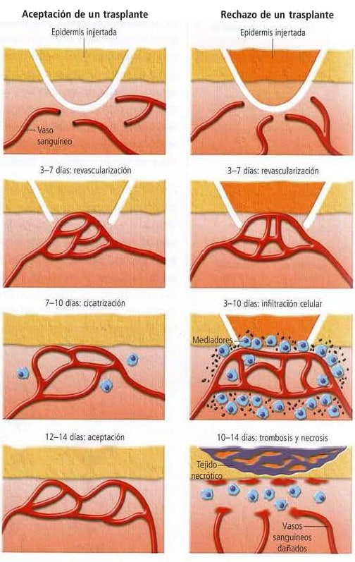 Complejo mayor de histocompatibilidad