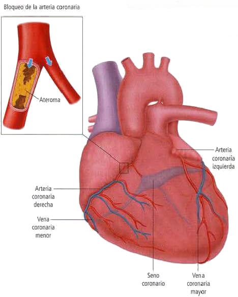 Enfermedades del sistema circulatorio